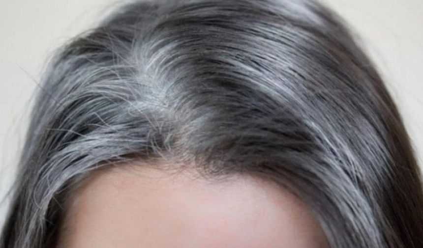 Dökülen Beyaz Saçın Yerine Yenisi Çıkar Mı Beyaz Saç Koparmak Günah Mı (3)